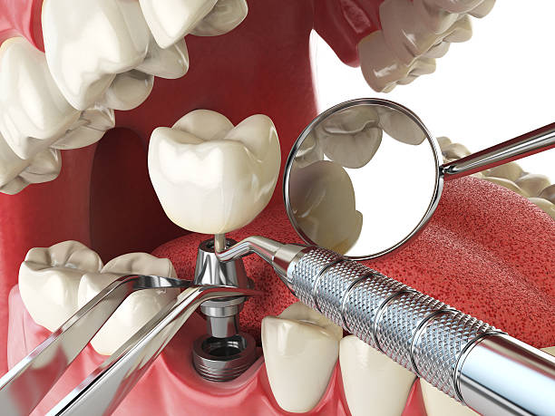 Best Emergency Dental Surgery in Drum Point, MD